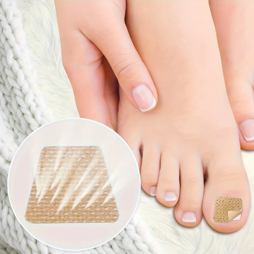 Toenail Patch Nail Repair Patches Nail Ingrown Correction